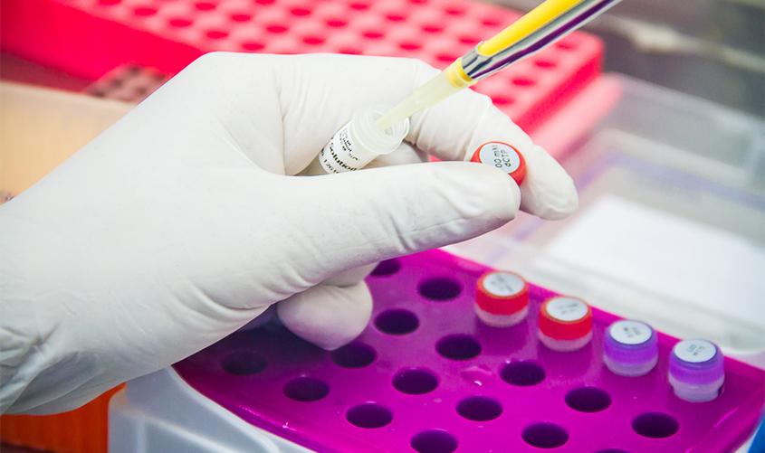 51 casos suspeitos de coronavírus estão sendo monitorados nesta em Rondônia 