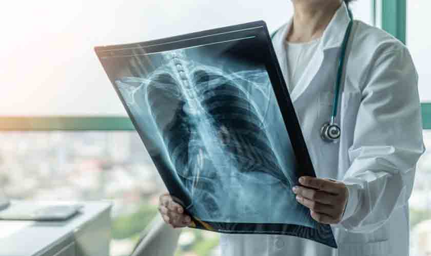 Dispensa de industriária por tuberculose preexistente não configura discriminação