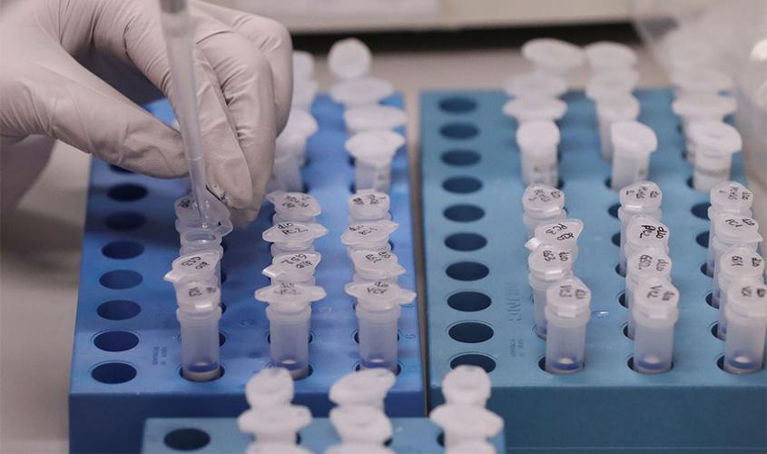 ANS determina cobertura obrigatória do teste sorológico para Covid-19; paciente deve ter atenção aos critérios