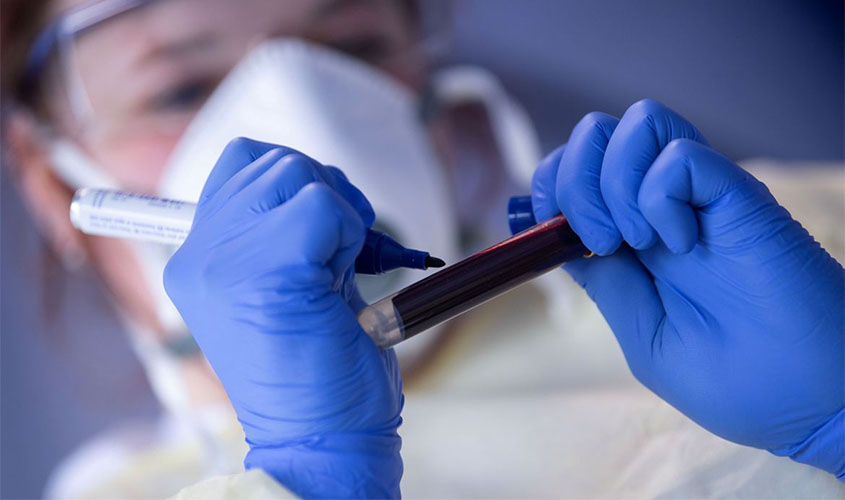 Covid-19: Brasil tem 3,4 milhões de casos e mais de 109 mil mortes