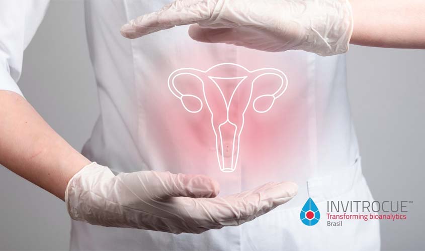 Silencioso e de difícil diagnóstico precoce: câncer de ovário