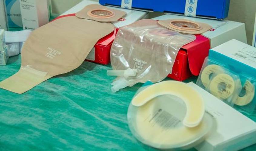 Programa de ostomia na POC proporciona maior qualidade de vida para pessoas ostomizadas