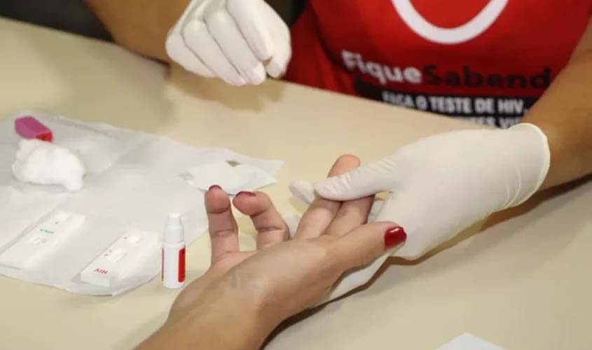 Alta de casos de HIV reacende debate sobre diagnóstico