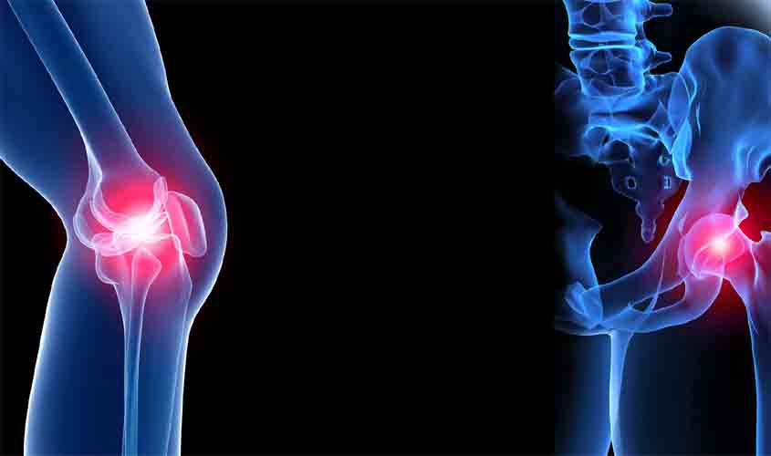 Ferida na pele pode causar infecção nos ossos? Entenda o que leva à osteomielite