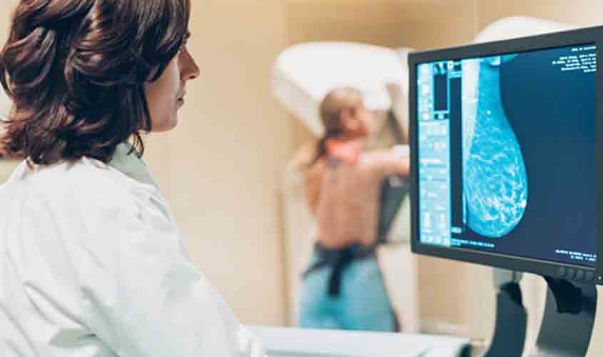 Câncer de mama: pacientes deixam de realizar procedimentos durante a pandemia