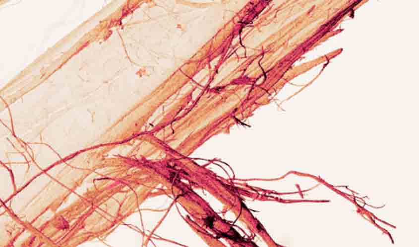 Filhos de advogado que morreu com doença relacionada ao amianto serão indenizados