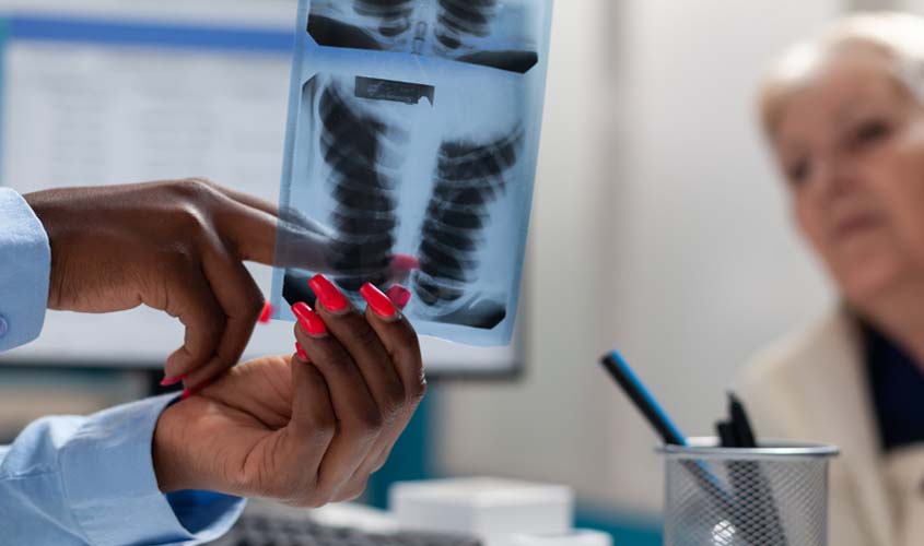 Pneumonia em idosos: atenção aos sinais atípicos