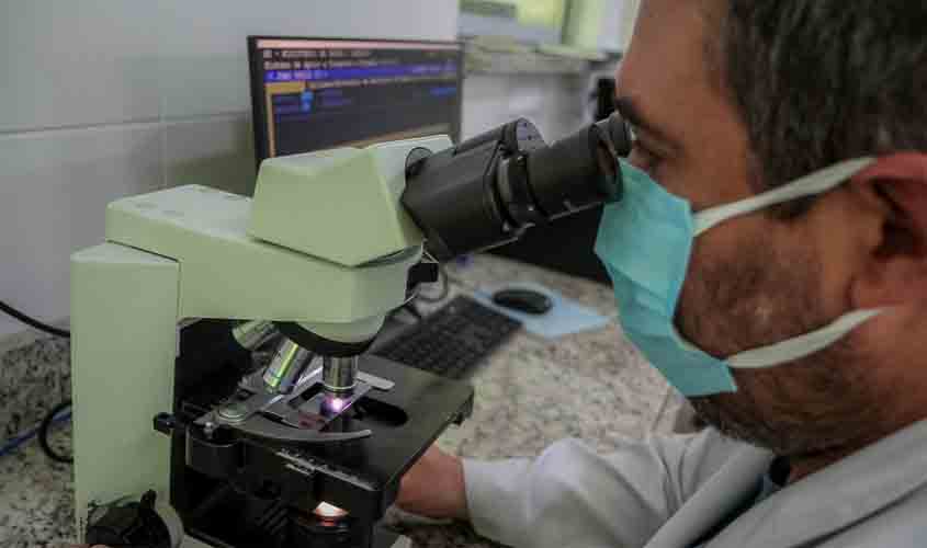 Governo de Rondônia vai investir mais R$ 150 mil em programa de pesquisa do SUS