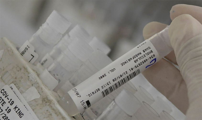 Saúde atualiza dados da pandemia; 3,5 milhões de casos registrados