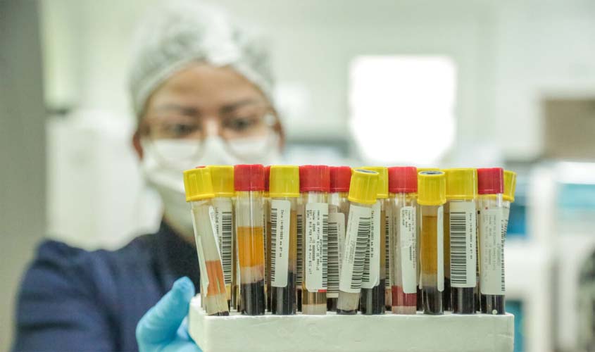 Serviço de acesso aos resultados de exames do Lepac é integrado ao Portal do Cidadão