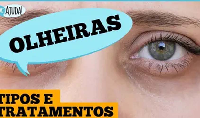 Olheiras: por que aparecem e o que fazer