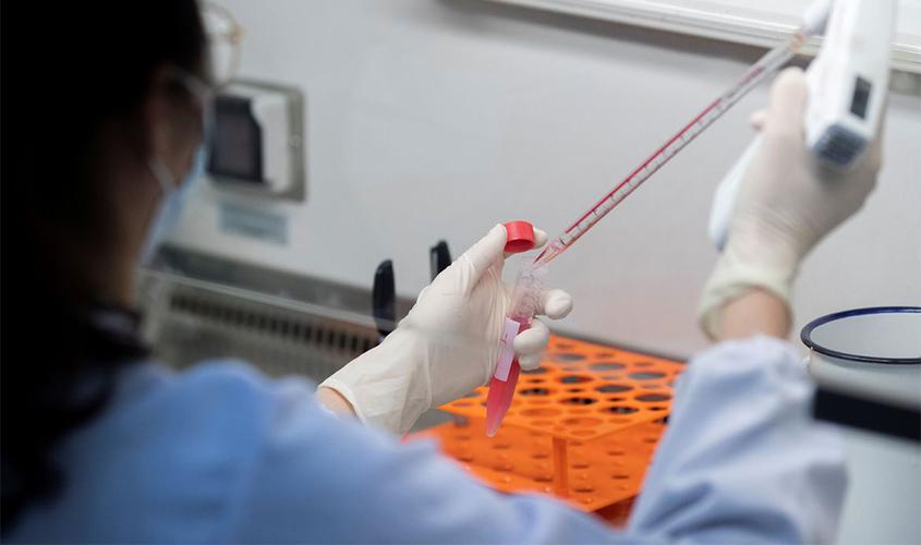 Anvisa faz orientações sobre uso de plasma para combater covid-19