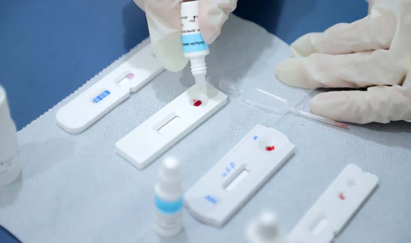 Porto Velho fornece diagnóstico e tratamento para hepatites