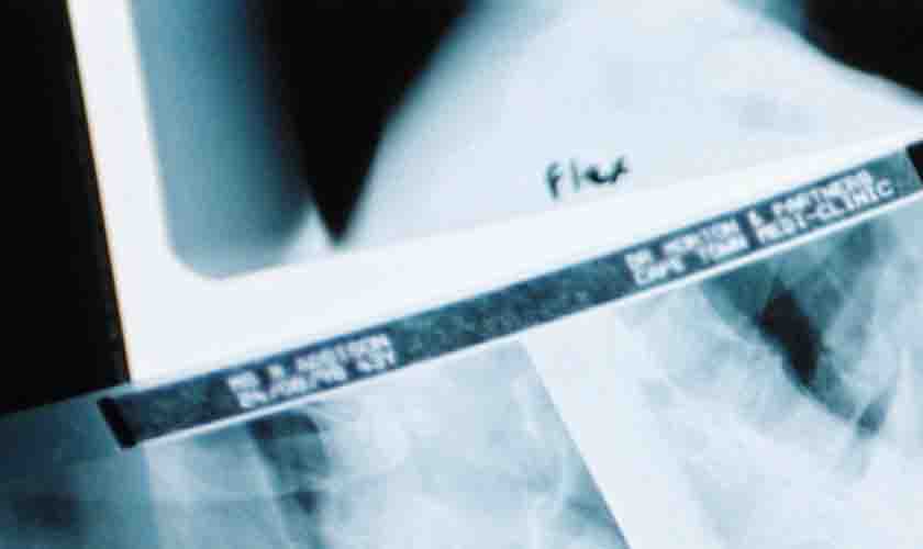 Causas múltiplas de lesão na coluna não afastam direito de empregado à estabilidade