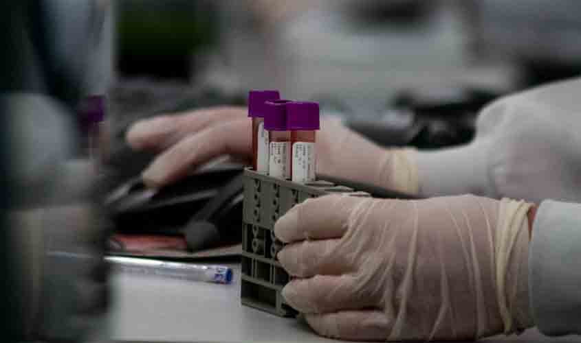 Agevisa inicia trabalhos científicos para ampliação de estudos sobre doenças raras em Rondônia