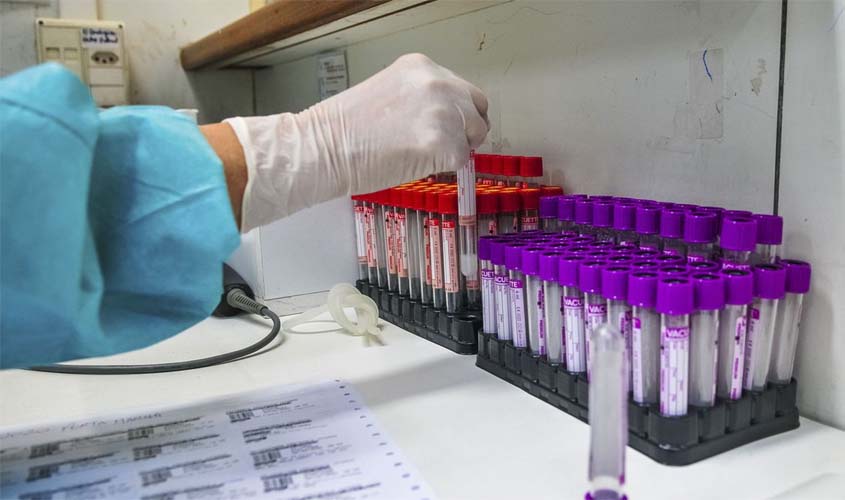 Covid-19: Brasil tem 33,5 mil novos casos e 836 mortes em 24 horas