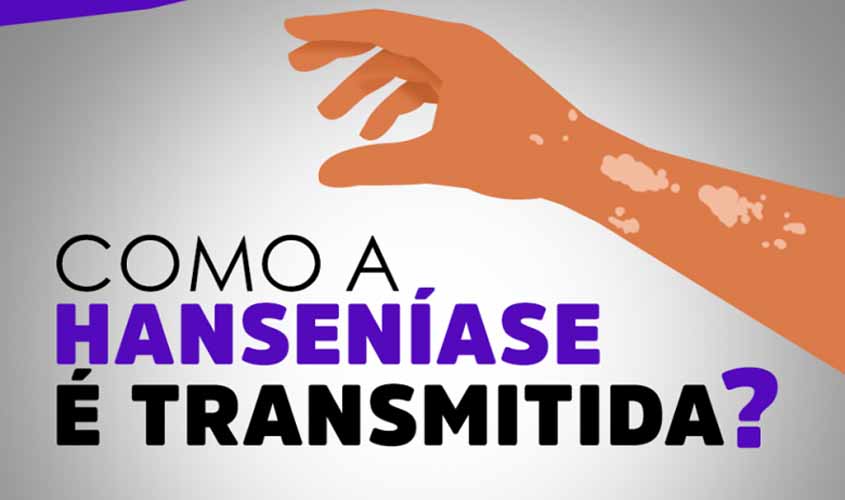 Semusa alerta para o diagnóstico precoce da Hanseníase