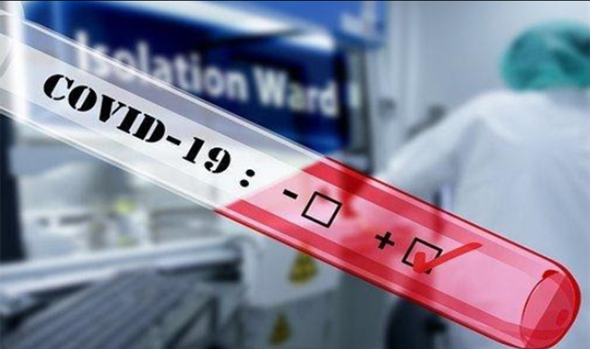 Covid-19: mortes no Brasil sobem para 34 e casos confirmados são 1.891