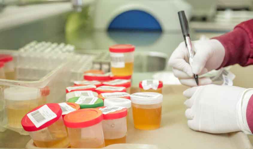 Pesquisas sobre doenças tropicais são ampliadas no estado pelo governo de RO