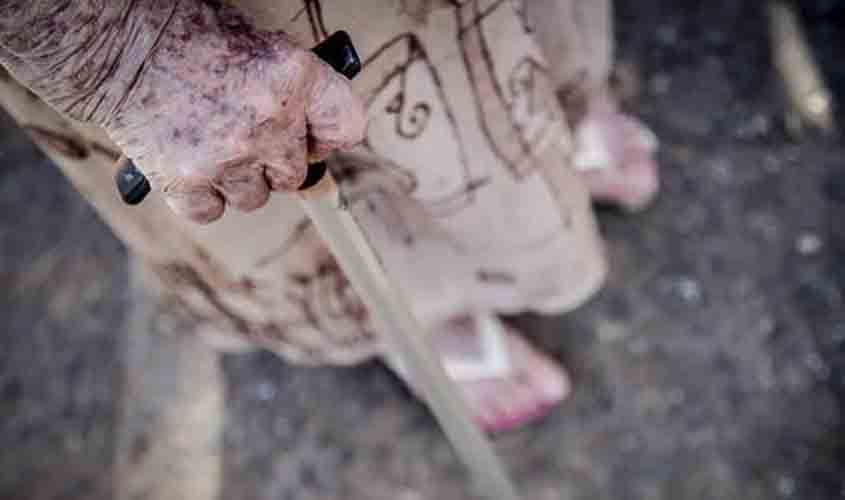 Acidente doméstico: 1 em cada 3 idosos sofre uma queda por ano, estima Into