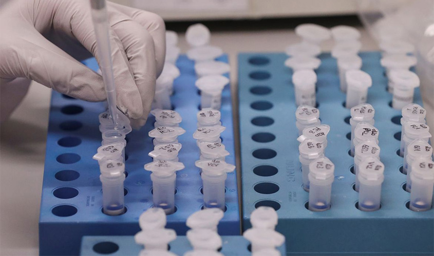 Capes oferece novas bolsas de estudo para pesquisas sobre coronavírus