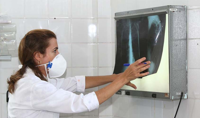 Brasil registra 78 mil novos casos de tuberculose