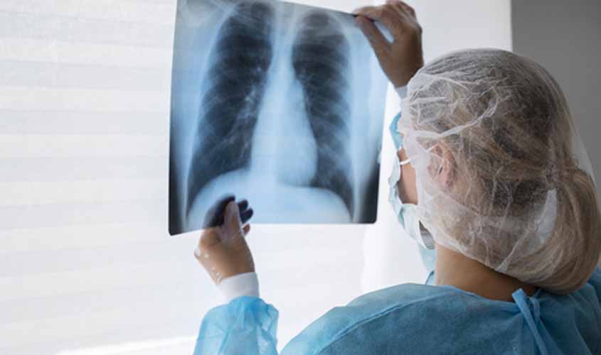 TUBERCULOSE: Brasil está no grupo de países responsáveis por 82% de casos no mundo