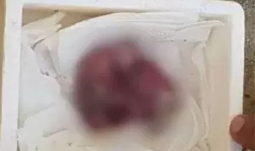 Homem aciona polícia após encontrar suposto feto humano em caixa de isopor