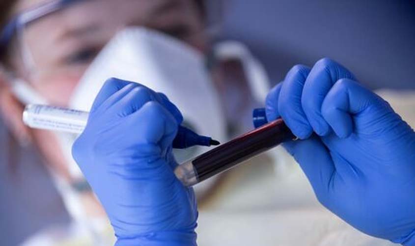 Quase 18 milhões de brasileiros fizeram teste para detectar novo coronavírus, diz IBGE