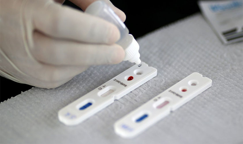 Covid-19: Brasil tem 139 mil mortes e 4,65 milhões de casos acumulados