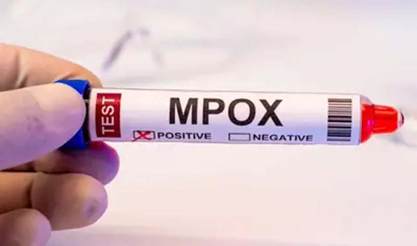 Mpox: Brasil registra 88 casos em 2026; veja sintomas