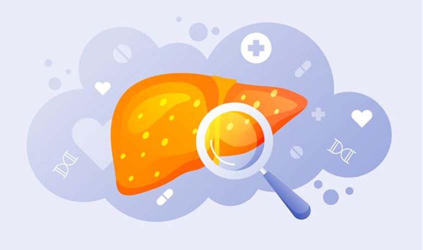 Hepatites Virais: Quais São Os Sintomas, Causas E Prevenção?
