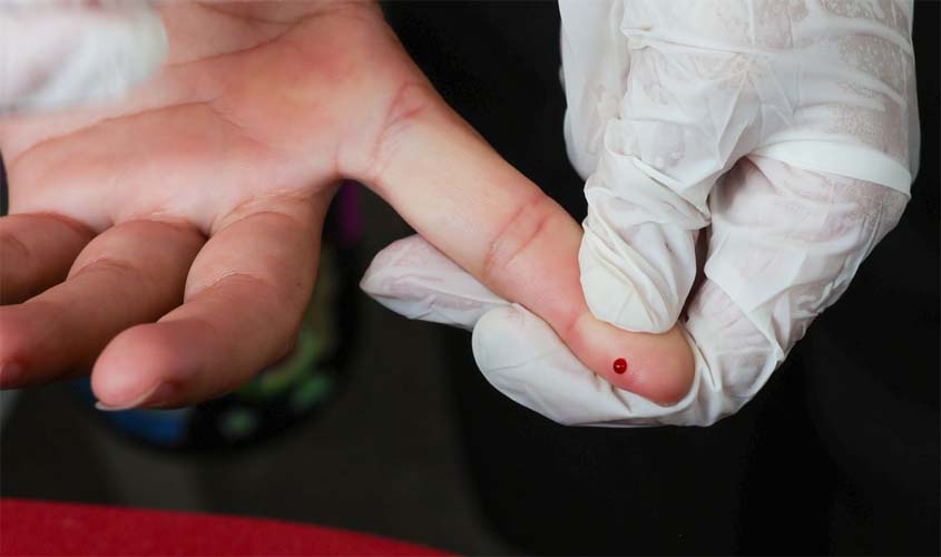 SUS passa a oferecer teste rápido de dengue