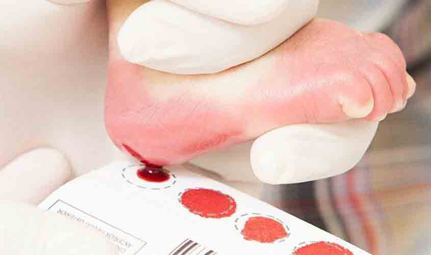 Bolsonaro sanciona lei que amplia o teste do pezinho no SUS