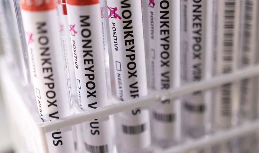 Varíola dos macacos: com 813 casos, Brasil tem situação 'preocupante'