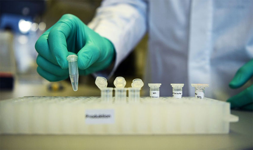 Covid-19: Brasil tem 117 mil mortes e 3,7 milhões de casos acumulados