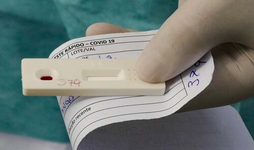 Brasil atinge a menor média de mortes por Covid-19 desde maio, diz Fiocruz