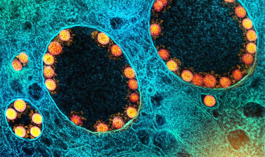 Covid-19: em 24 horas foram registrados 44.830 novos casos