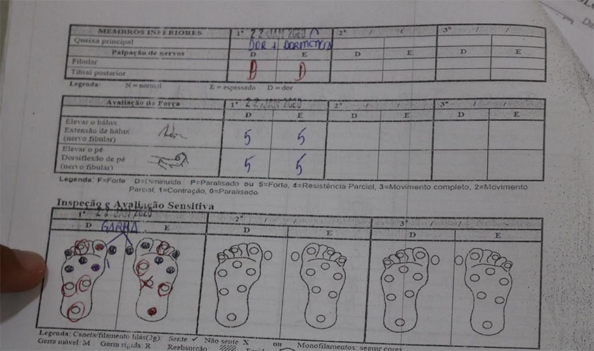 POC registrou mais de 700 novos casos de Hanseníase em 2019