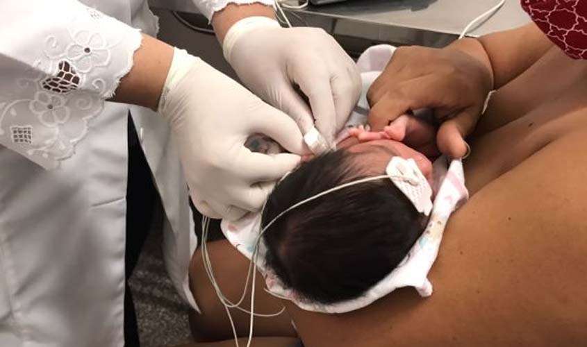 Teste da orelhinha realizado por fonoaudiólogos alcança 99,6 % dos recém-nascidos do Hospital de Base Dr. Ary Pinheiro