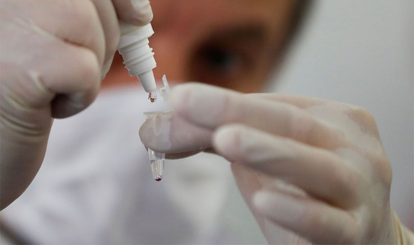 Teste da Unesp identifica assintomáticos de covid-19 pela saliva