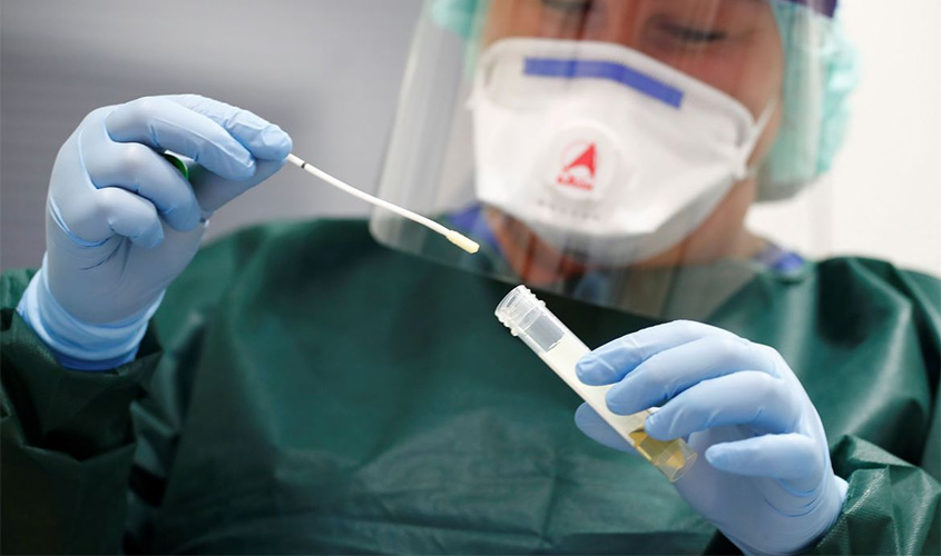 Covid-19: Brasil tem 157,9 mil mortes e 5,43 milhões de casos