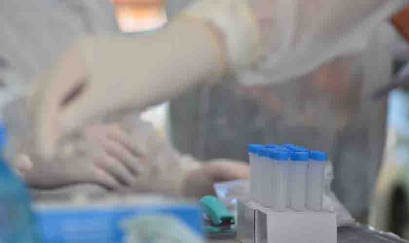 Vilhena fará testagem em massa neste domingo para conter a disseminação da covid-19