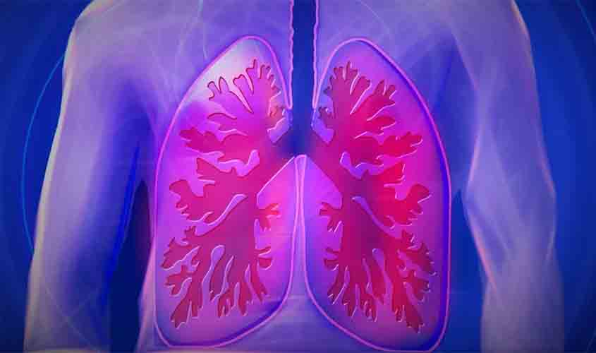 Inovação a serviço da saúde pulmonar