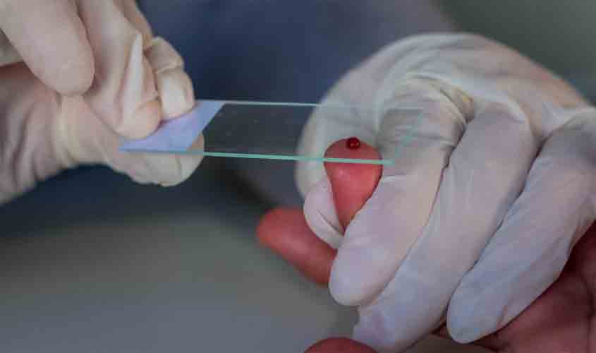 Governo desenvolve ações em parceria com municípios para combater casos de malária em Rondônia