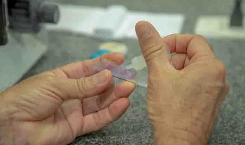 Criadouros são favorecidos no período de chuvas e devem ser combatidos