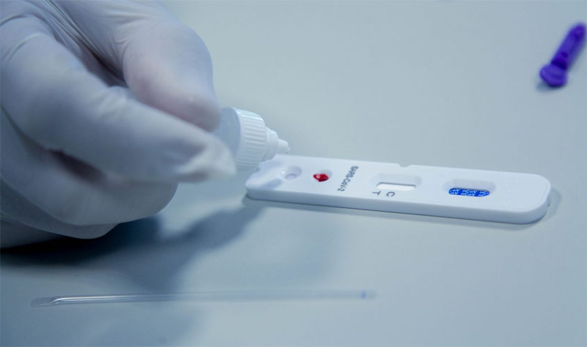 Governo oficializa entrega de 100 mil testes rápidos para distribuição aos municípios