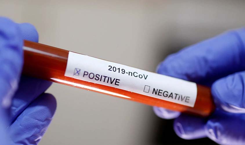 Maranhão diz que monitora dois casos suspeitos do novo coronavírus