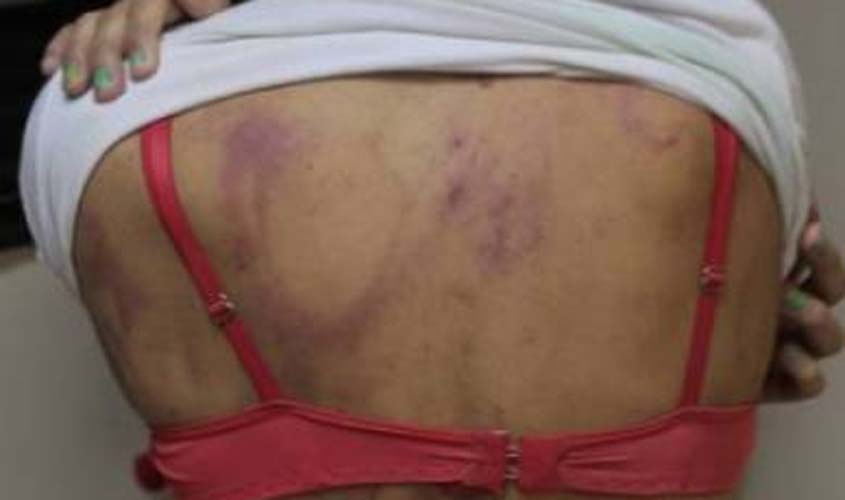 Suposto membro de facção criminosa espanca adolescente com quem foi casado e a impede de chamar a polícia sob ameaça de morte