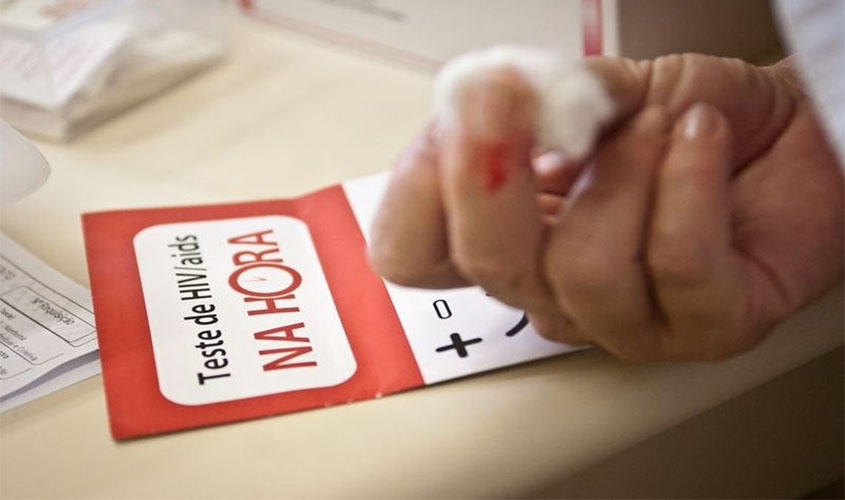 Ministério da Saúde: 135 mil convivem com HIV no país e não sabem